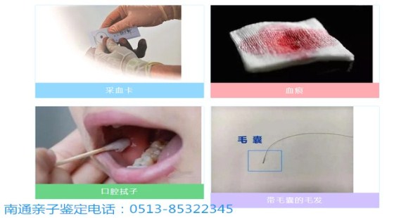 在南通办理亲子鉴定要注意什么?一则本地案例告诉你该怎么选